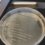 Bakterien auf Agarplatte